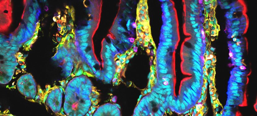 Continuum et microbiote, une rencontre du 2ieme&nbsp;type!